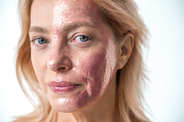 Adult woman with moisturizing facial mask at the half of her face