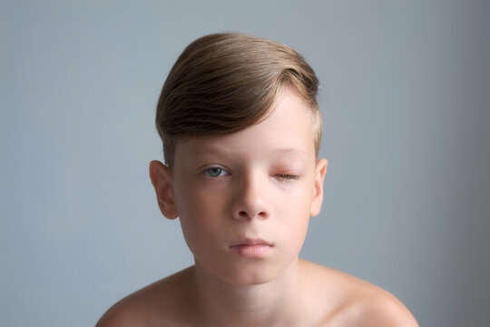 Portrait of a boy with a swollen eye from an insect bite. Allergic reaction to insect bites. Closed red sick eye of a teen boy. Eye disease in a child, conjunctivitis, inflammation in the eye.