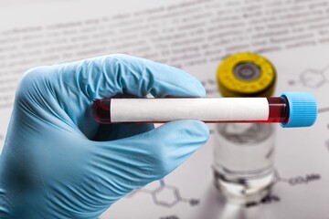 Doctor with a positive blood sample for new variant detected of the coronavirus strain. Research