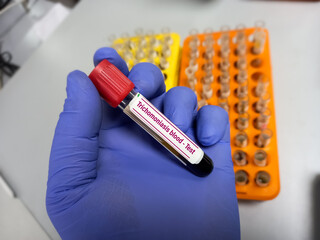 Blood sample for Trichomoniasis test, diagnosis of Syphilis, Gonorrheal disease