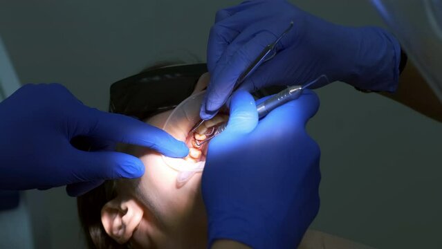 Dentist puts the thread to stop the bleeding between tooth and gum of the patient. Close-up of the oral cavity in the process of dental treatment. Dentistry, prosthetics concept. Orthodontist cure.