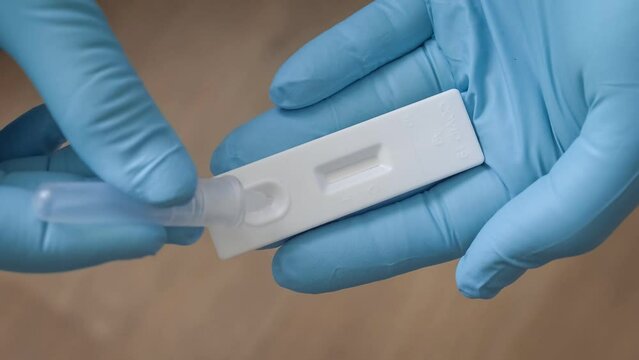 Positive antigen rapid test on COVID-19 coronavirus in hand of doctor