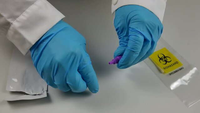 antigenic swab, covid 19 virus detector, with test tube, liquid, negative result, performed by the hands of a doctor with blue gloves. 