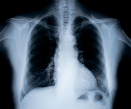X-Ray image isolated on white