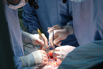 Closeup of professional doctor hands operating a patient during open heart surgery in surgical...