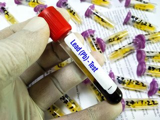 Blood sample tube for Lead (Pb) test at medical laboratory. To diagnosis lead toxicity