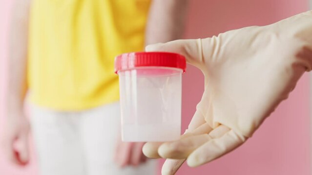 The unfocused man zips up his pants and passes a jar with a sample of semen for analysis into the hands of a doctor. Close-up. The concept of sperm donation.