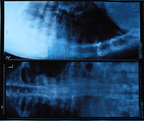 X-ray photography of back bones