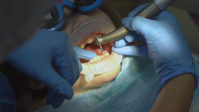 little girl with oral dilator at dentist's appointment. polishing of teeth