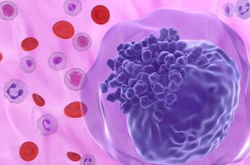 Acute myeloid leukemia (AML) cell in blood flow - super closeup view 3d illustration - obrazy, fototapety, plakaty