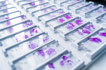 Rows of microscope glass slide in the cells