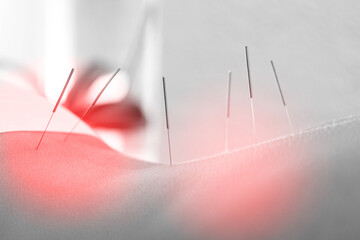 Close-up of female body with steel needles inserted during procedure of acupuncture therapy - obrazy, fototapety, plakaty