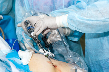 Hands of surgeons with laparoscopic surgical manipulators during proctological surgery. Selective focus.