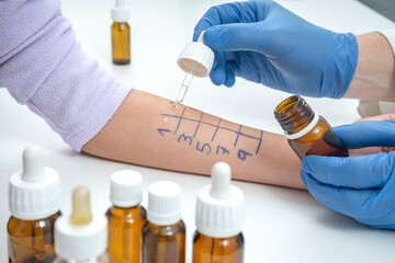 ALLERGY SKIN TEST. HEALTH CARE CONCEPT. HEALTH INSURANCE.