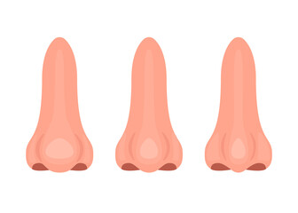 Different nose, correction nasal big and thin, surgery rhinoplasty. Nose before and after treatment. Vector illustration
