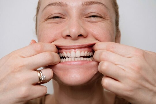 Girl Showing Her Teeth Stretching Her Mouth With Her Hands