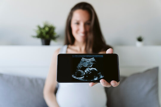 Woman showing ultrasound scan through mobile phone at home