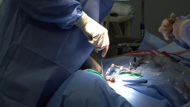 Spine Surgery Images Browse 26 369 Stock Photos Vectors And Video 