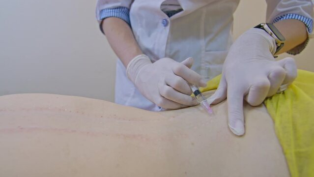 Beauty and injection concept. Cosmetology in the clinic. An experienced beautician wearing white gloves injects subcutaneous injections with the necessary active ingredients into the woman's back for
