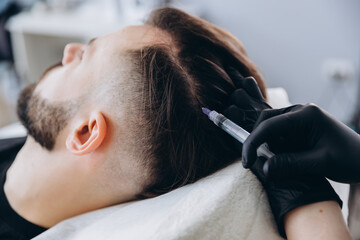 Mesotherapy procedure. A cosmetologist performs a mesotherapy procedure on the head of a young man....