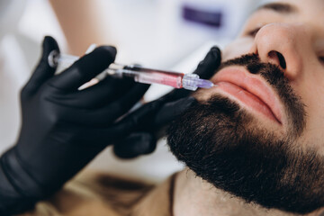 Increased lip size for men. Injection of hyuleronic acid into the lips of a young stylish bearded man.