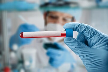 Medical laboratory assistant holding tube, Omicron COVID-19 concept