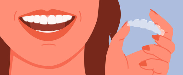 Cartoon woman holding invisalign transparent braces with smile, orthodontic denture banner template background. Invisible dental braces correction for tooth, dentistry health care vector illustration