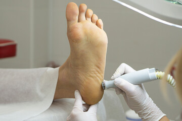 Callus peeling using professional pedicure drill machine. Spa foot treatment. Removing hard,...