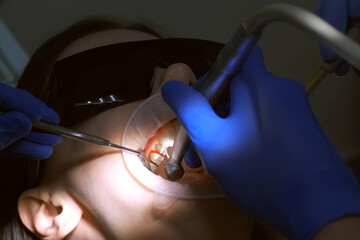 Naklejka premium Dentist is preparing woman's teeth for installing ceramic veneers and crowns using drill. He is removing partly an enamel of the teeth. Dentistry, prosthetics concept. Treatment by an orthodontist.