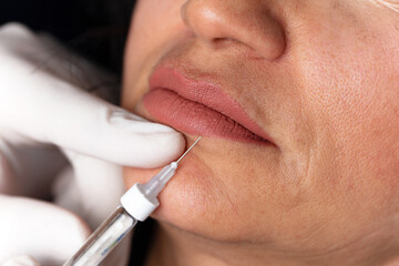 lady getting botox injection for bigger, fuller lips. The woman in the beauty salon. Plastic...