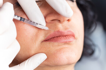 lady getting botox injection for bigger, fuller lips. The woman in the beauty salon. Plastic surgery clinic.