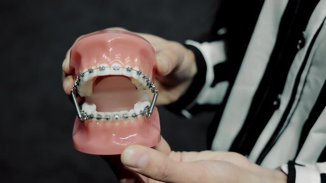 The dentist holds an artificial dental jaw with orthodontic braces on his teeth. Demonstration of orthodontists and braces on the model.