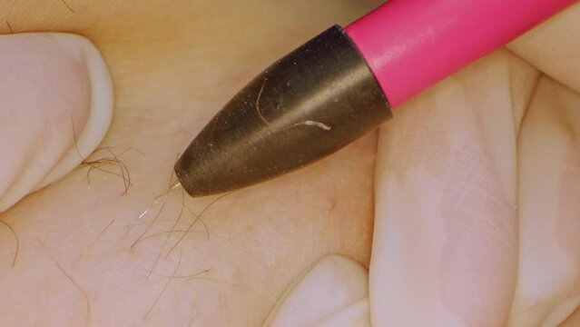 Tracking Macro Extreme Close-Up Shot of electric electrolysis epilation, hair removal, with Laowa Lens and dolly slider zoom. 4k prores 422.