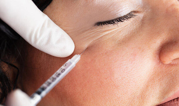 Plastic surgery clinic. Hands of cosmetologist making botox injection holding Syringe. Concept of healthy face, skin care, middle age skin care cosmetics, aesthetics.

