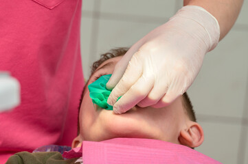 The dentist installs a rubber dam and a clamp for the treatment of a diseased tooth.