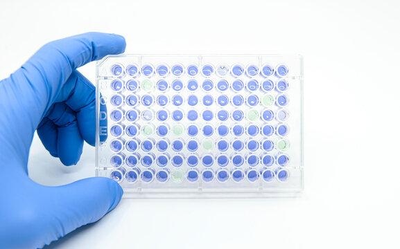 Scientist is holding 96 well micro plate that  tested enzyme linked immunosorbent assay(ELISA) for drug screening in laboratory