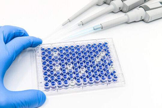 Scientist is testing ELISA immunoassay by 96 well micro plate and pipettes