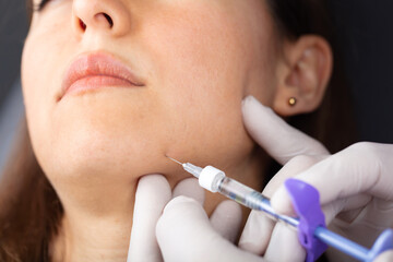 Botox injection to the face in the chin area. aesthetics, medicine concept. Botulinum toxin. youth...