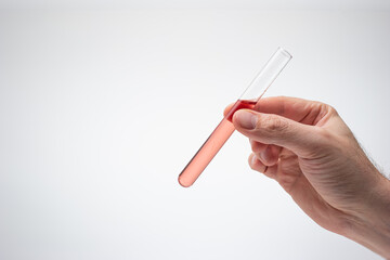 Medical test tube containing a light pink liquid held in hand by Caucasian male. Close up studio shot, isolated on white background