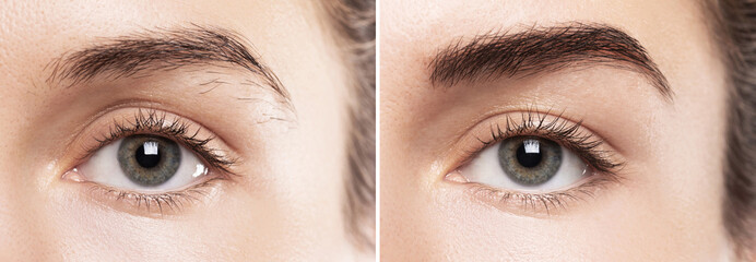 Comparison of female brow after eyebrow shape correction