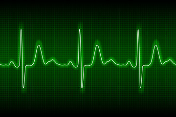 Heart beat ecg or ekg seamless neon line on green background. Electrocardiogram graph of healsh cardio rate. Examination of human health. Medicine test cardiac rhythm and pulsating inteval.