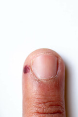 Toes, hands, finger, and nails. Male human body parts 30 to 40 years old