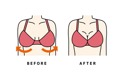 バスト　補正下着　ビフォーアフター