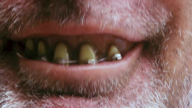 Close up of a creepy funny smile from a shy, quirky flirtatious older nerd with stained buck teeth in need of some dental health.