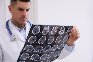Doctor examining MRI images of patient with multiple sclerosis in clinic