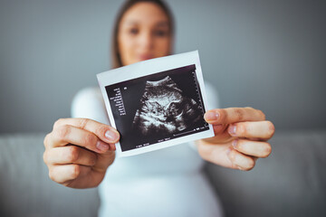 Happy young pregnant woman holding an ultrasound scan image. Smiling beautiful mother with...