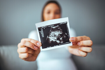 Happy young pregnant woman holding an ultrasound scan image. Smiling beautiful mother with ultrasound of her unborn baby. Pregnancy concept, maternity prenatal care.