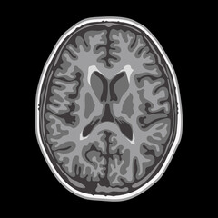 Brain MRI axial cut - obrazy, fototapety, plakaty