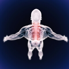 Facing crippling inflammation and pain. A high angle view of a cgi representation of the human skeletal structure.