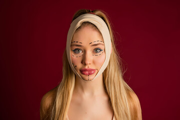 Luxurious woman and plastic surgery moment. Exaggerated injection to the lips of a beautiful blonde